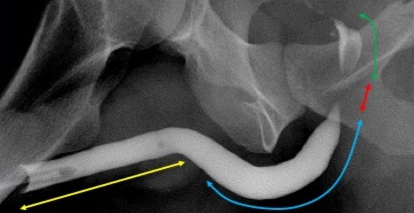 Retrograd üretrografi Fiyatları 2023 - Emar Tomografi