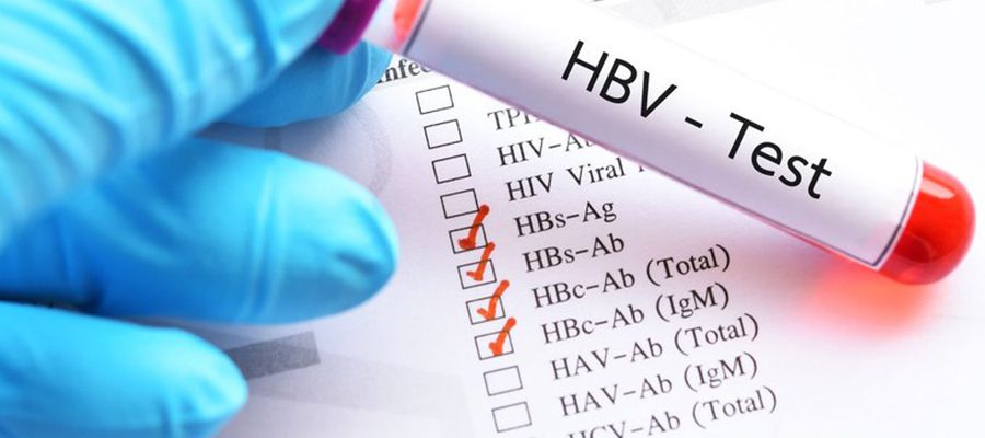 anti hbs kan testi fiyatları