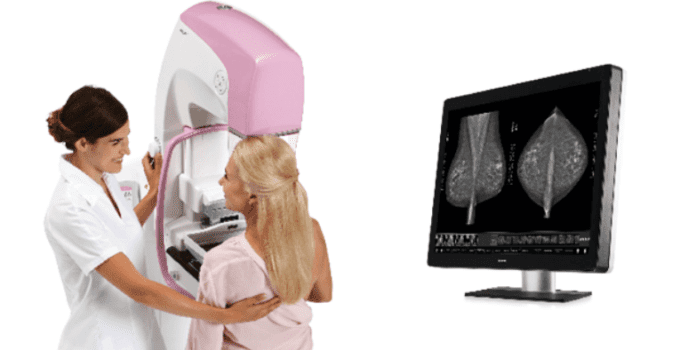 ultrason ve mamografi