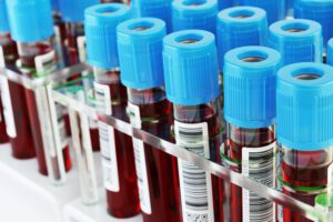 sodyum kan testi fiyatları
