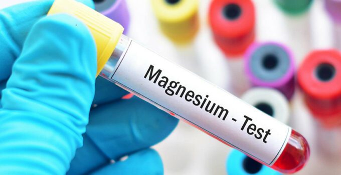 magnezyum testi nedir