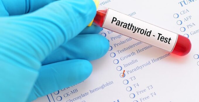 paratiroid hormon testi