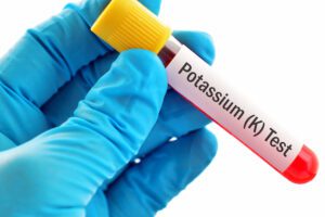 Potasyum kan testi fiyatları