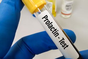prolaktin testi nedir