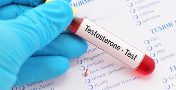 testosteron testi nedir