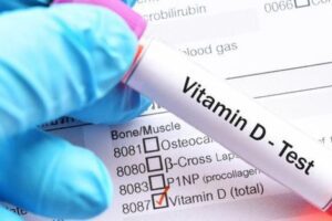 25 hidroksi d vitamini testi ücreti
