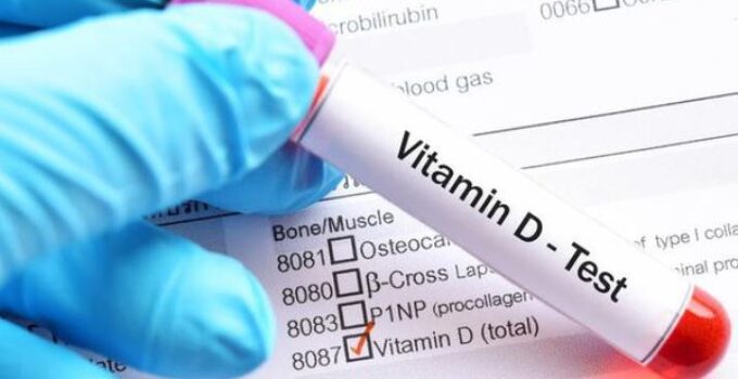 25 hidroksi d vitamini testi ücreti