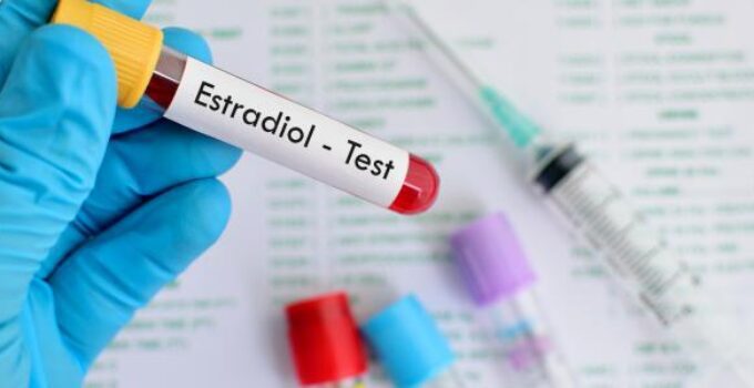 estradiol testi nedir
