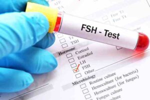 fsh testi nedir
