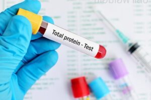 total protein testi ücreti