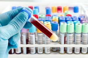 quantiferon testi nedir