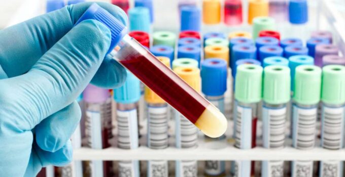 quantiferon testi nedir